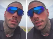 Francesco Chiofalo, prime foto dopo l’intervento per il cambio del colore degli occhi 2