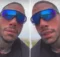 Francesco Chiofalo, prime foto dopo l’intervento per il cambio del colore degli occhi 7