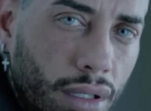 Francesco Chiofalo e il nuovo intervento di chirurgia 2