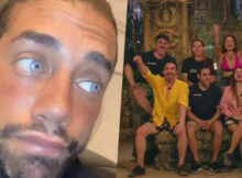 Un ex concorrente dell’isola dei famosi si opera agli occhi 5