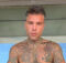 Fedez ricoverato d’urgenza 4