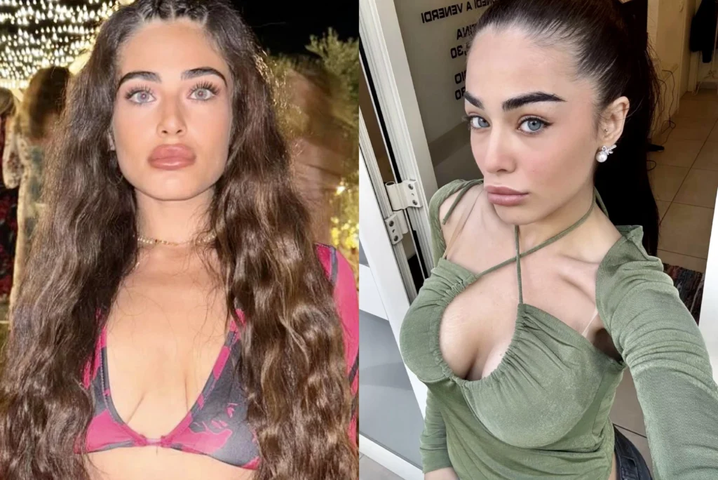 Temptation Island, Siria si rifà il seno 2