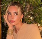 Sophie Codegoni elimina il filler alle labbra 13