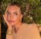 Sophie Codegoni elimina il filler alle labbra 4