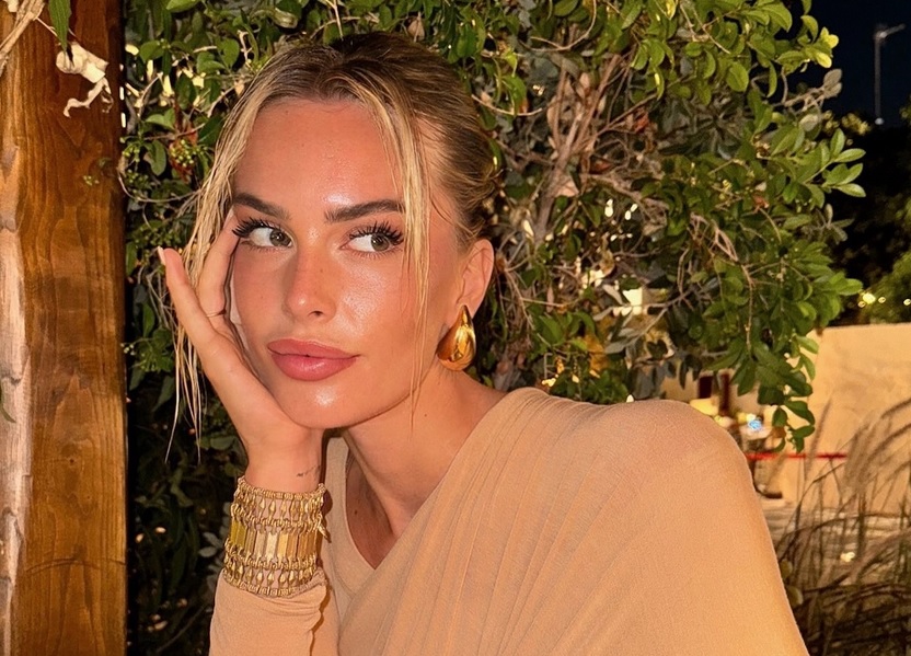Sophie Codegoni elimina il filler alle labbra 1