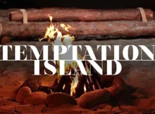 Temptation Island, ex protagonista si è sottoposto ad un trapianto di capelli 3