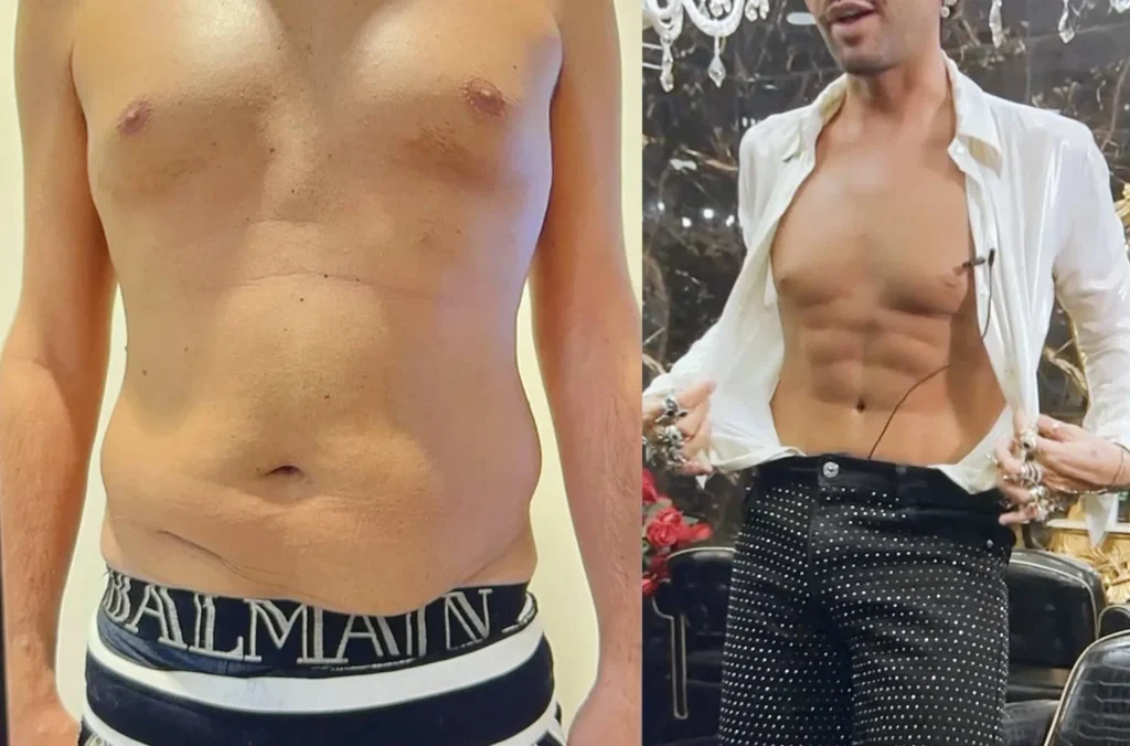 Federico Fashion Style e il particolare intervento di chirurgia 2