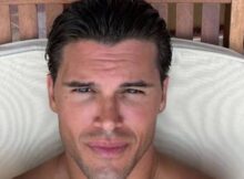 Antonio Medugno rompe il silenzio e parla dopo la denuncia per Alfonso Signorini 6