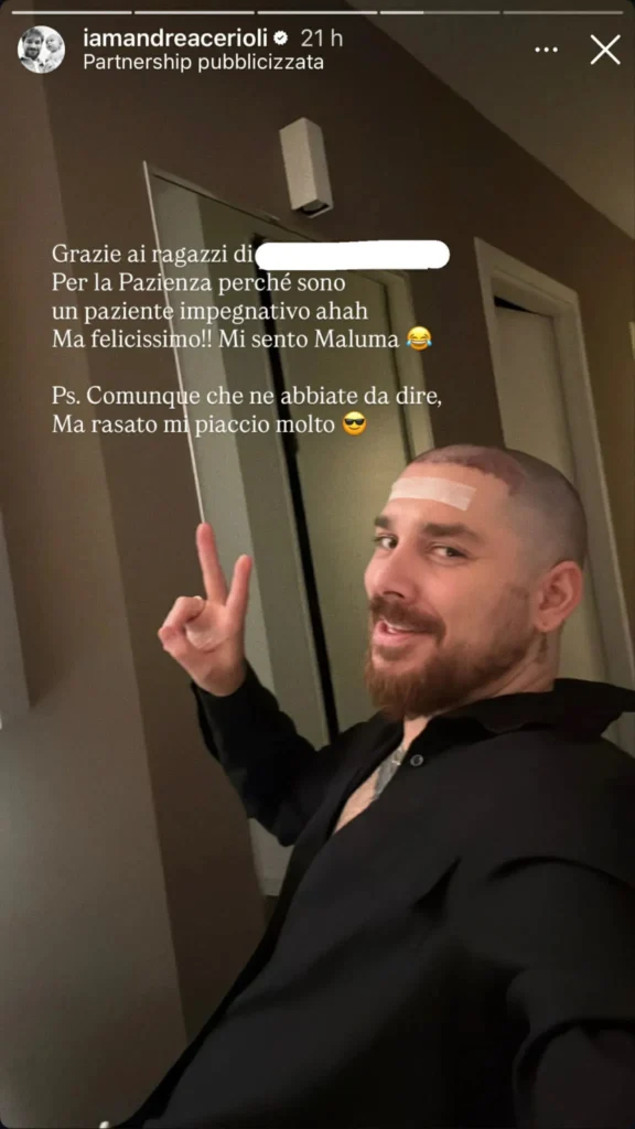 Uomini e donne, ex tronista si è sottoposto ad un trapianto, botox e liposuzione 2