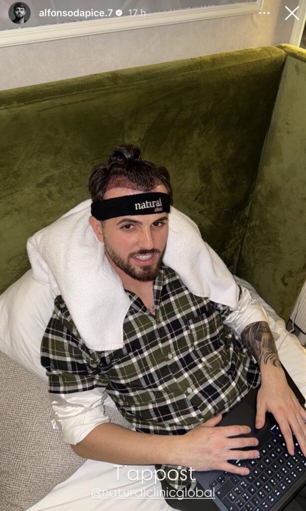 Grande Fratello, Alfonso si sottopone ad ogni j intervento estetico 2