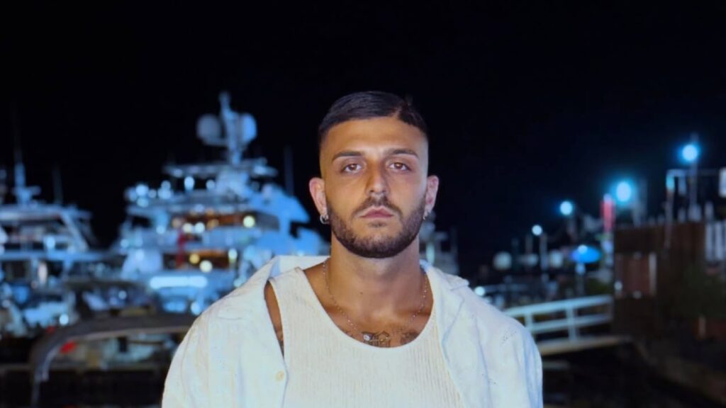 Uomini e donne, Ernesto si è sottoposto ad un intervento estetico 1