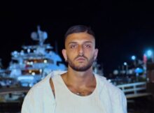 Uomini e donne, Ernesto si è sottoposto ad un intervento estetico 6