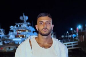 Uomini e donne, Ernesto si è sottoposto ad un intervento estetico 2