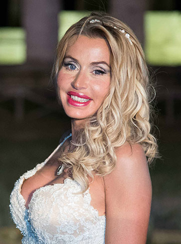 GFVIP, Valeria Marini vomita e da la colpa alla mela 1