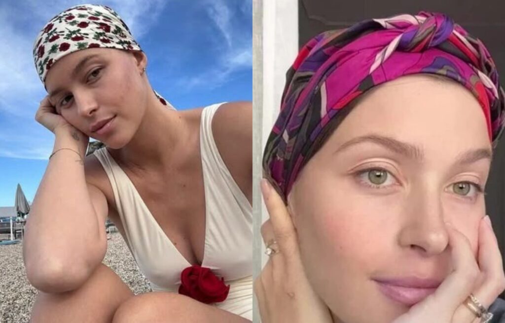 Natalia Paragoni rasa i capelli durante la chemioterapia, le immagini che commuovono 1