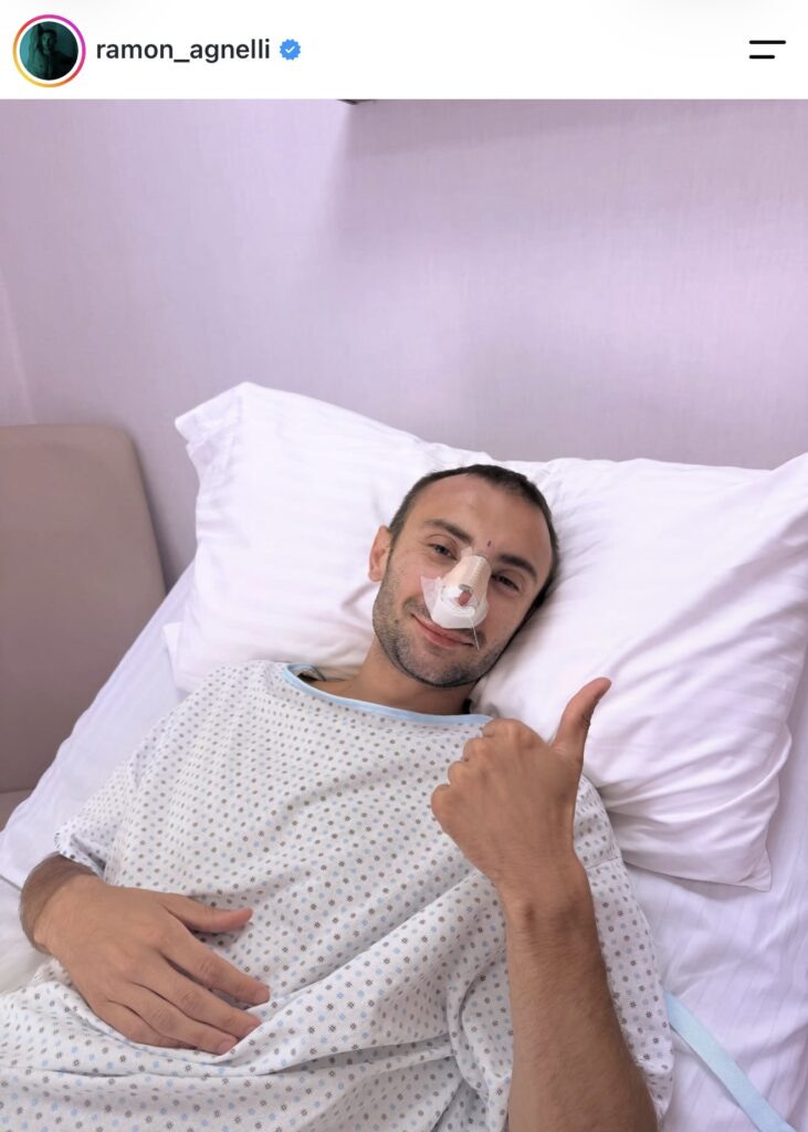Amici, Ramon ha rifatto il naso 2