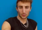 Amici, Ramon ha rifatto il naso 4