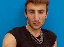 Amici, Ramon ha rifatto il naso 6