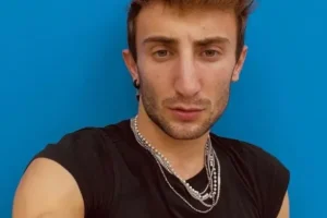 Amici, Ramon ha rifatto il naso 2