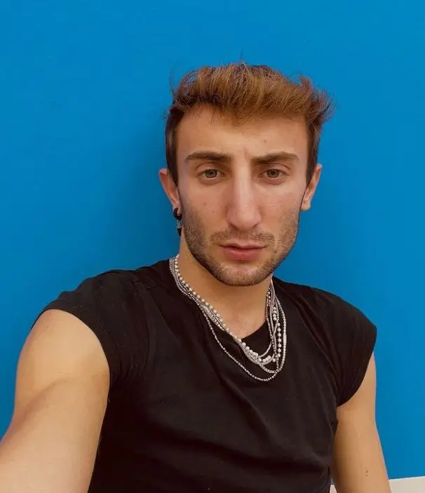 Amici, Ramon ha rifatto il naso 1