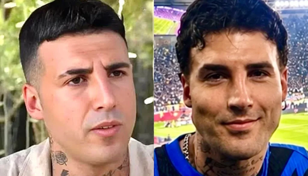 Temptation Island, Fabio Mascaro e il ritocco al volto 2