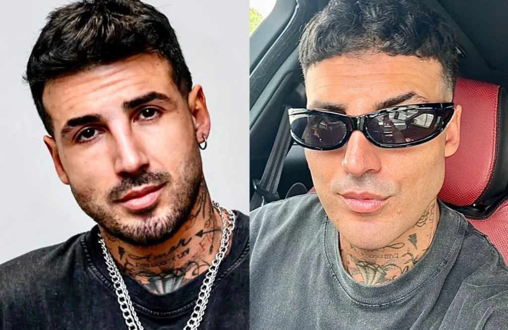 Temptation Island, Fabio Mascaro e il ritocco al volto 3