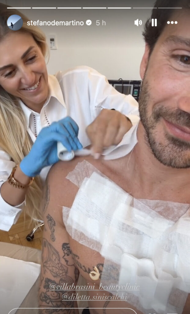 Stefano De Martino rimuove i tatuaggi 2