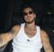 Temptation Island, Fabio Mascaro e il ritocco al volto 5