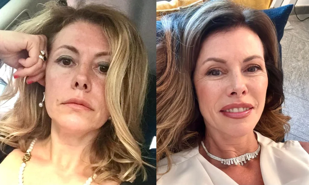 Uomini e donne, il prima e dopo di Cinzia 3