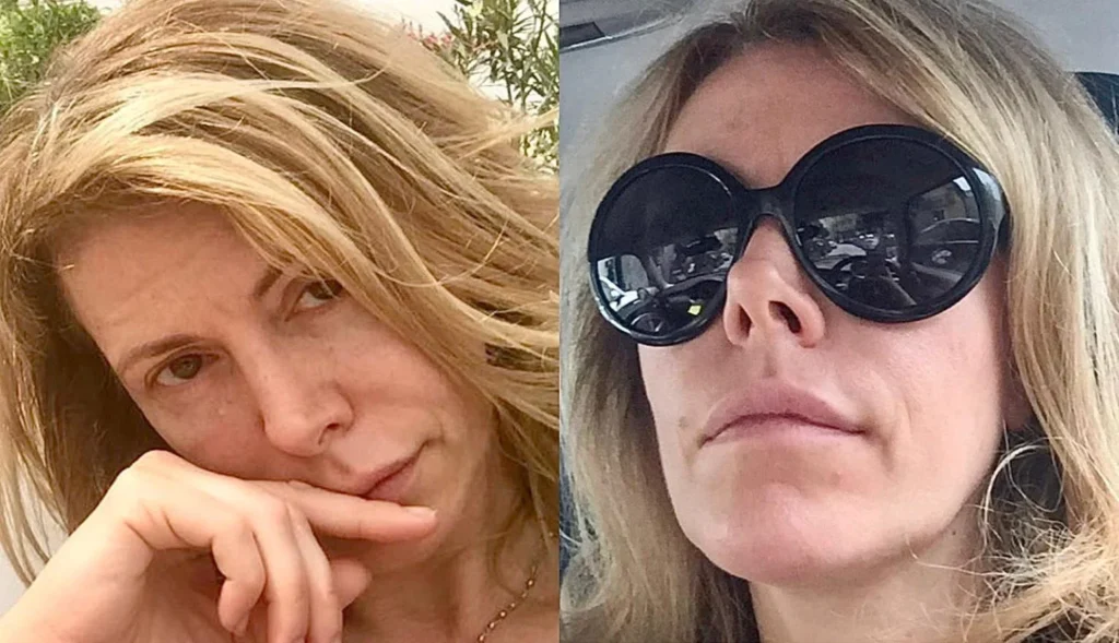 Uomini e donne, il prima e dopo di Cinzia 2