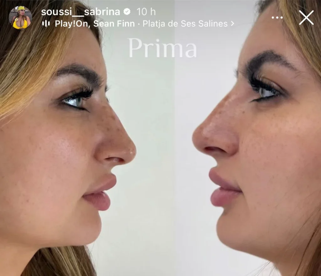 Temptation Island, Sabrina e quel ritocco chirurgico al viso 2